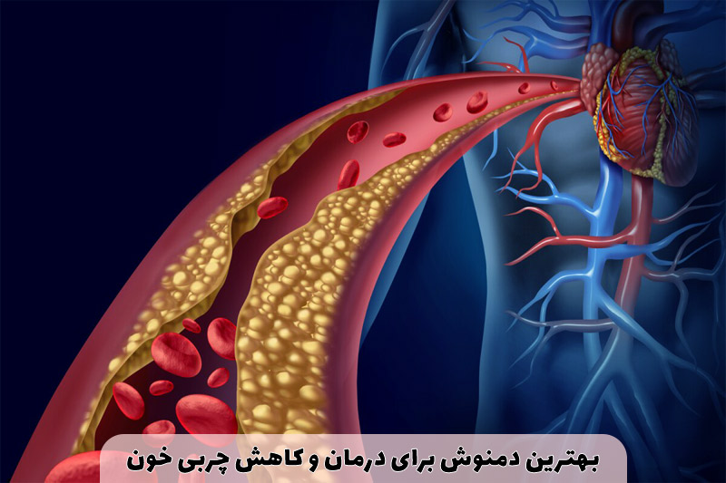 بهترین دمنوش برای درمان و کاهش چربی خون