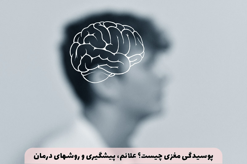 پوسیدگی مغزی چیست؟ علائم، پیشگیری و روشهای درمان