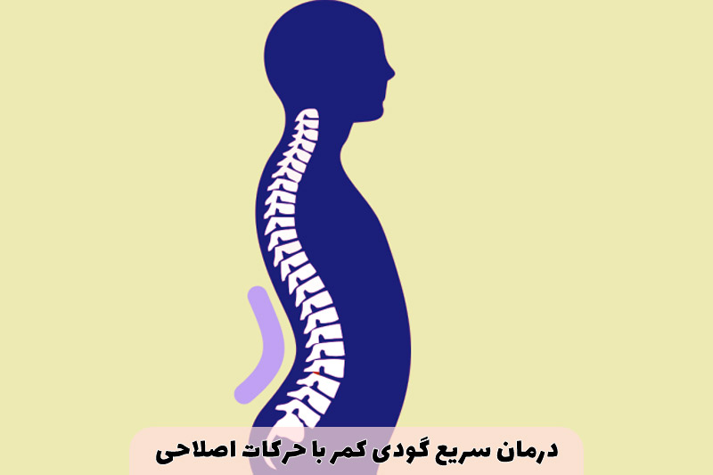 درمان سریع گودی کمر با حرکات اصلاحی